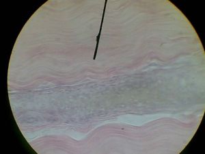 Плотная волокниста соединительная ткань сухожилия