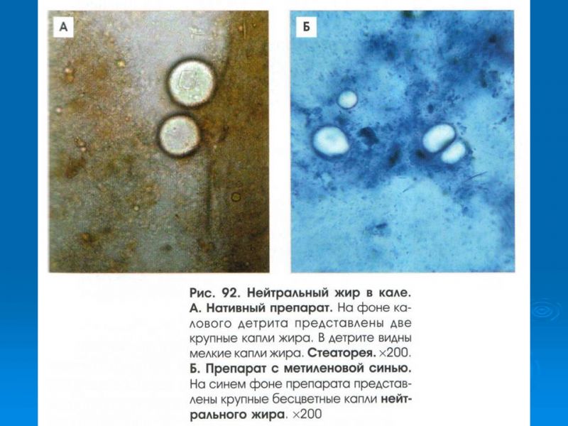 Реакция на белок в кале что значит. Копрология кала микроскопия. Микроскопия кала мышечные волокна. Микроскопия кала с метиленовым синим.