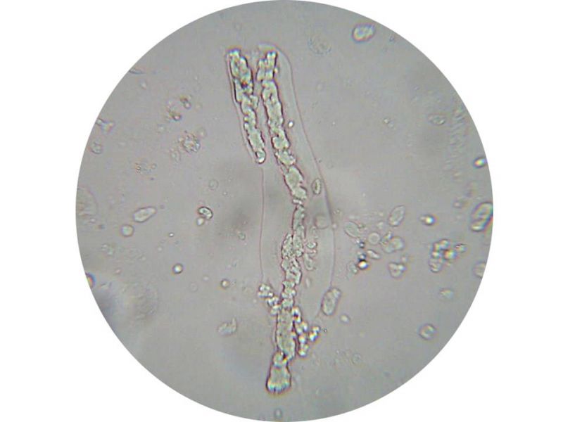 ФСВОК микроскопия осадка мочи. Уретральные нити в моче. Слизь в моче микроскопия. Слизь единичные