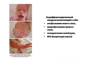 serdech010.jpg