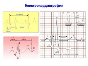 serdech030.jpg