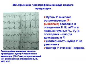 serdech031.jpg