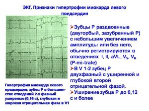 serdech032.jpg