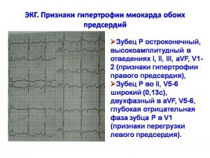 serdech033.jpg