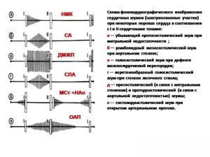 serdech039.jpg