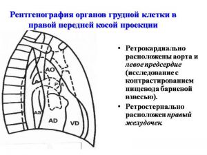 serdech045.jpg