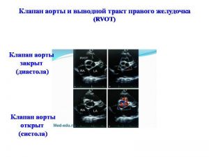 serdech053.jpg