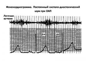 serdech085.jpg