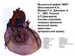 serdech093.jpg