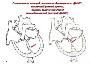 serdech097.jpg