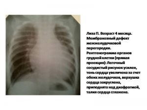 serdech102.jpg