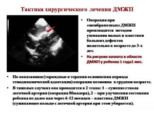 serdech108.jpg