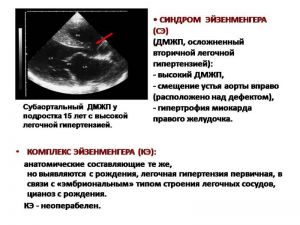 serdech109.jpg