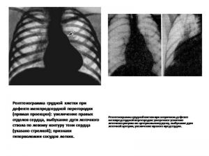serdech118.jpg