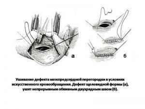 serdech125.jpg