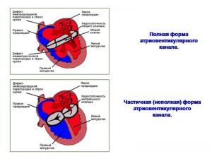 serdech131.jpg