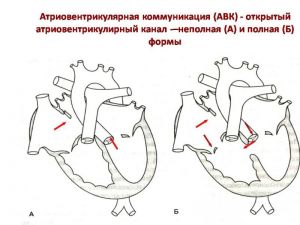 serdech132.jpg
