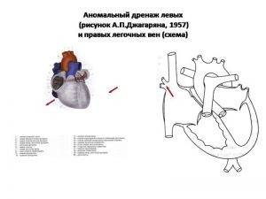 serdech140.jpg