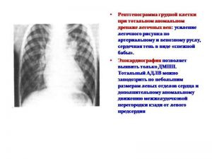 serdech147.jpg