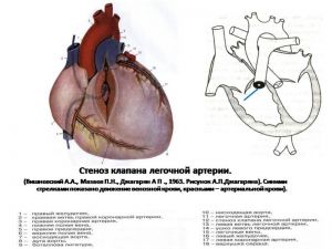 serdech151.jpg
