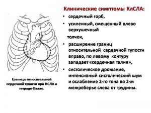 serdech153.jpg
