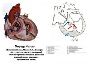 serdech160.jpg