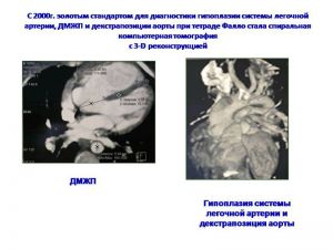 serdech178.jpg