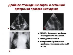 serdech202.jpg