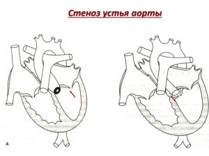 serdech204.jpg