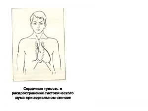 serdech206.jpg