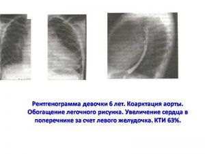 serdech217.jpg