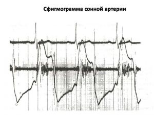 serdech219.jpg