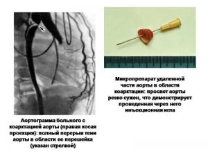 serdech224.jpg