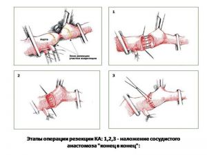 serdech230.jpg