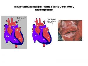 serdech231.jpg