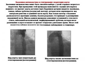 serdech232.jpg