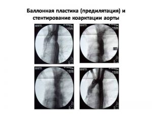 serdech235.jpg