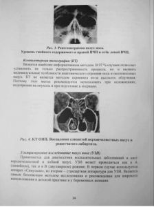 zabolevaniyanosa-24.jpg