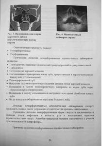 zabolevaniyanosa-31.jpg
